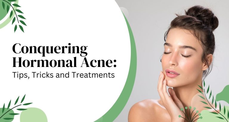Conquering Hormonal Acne: Tips, Tricks and Treatments