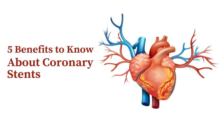 5 Benefits to Know About Coronary Stents