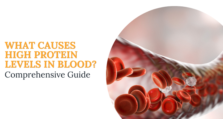 What Causes High Protein Levels In Blood? Comprehensive Guide